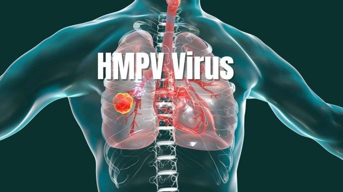 Ilustrasi Virus HMPV.